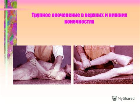 Презентация на тему: "Лeкция 1. Судебно-медицинская танатология. Учение ...
