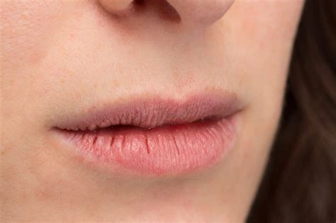 Chapped Lips: How Can You Make Them Soft & Smooth?