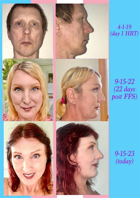 The Journey as it stands. Diane M2F 54 months HRT, age 58 : r ...