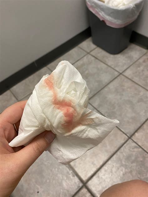 Watery Blood In Period