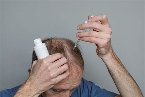 Batana Oil for Hair Loss: Benefits, Uses & Proven Results - Hermest Clinic