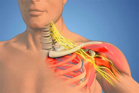 Brachial Plexus Injury Treatment in India | Plexus