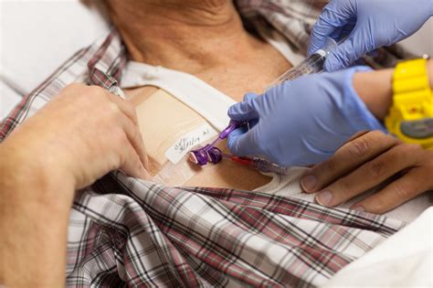 Leukemia Treatment Chemotherapy Chemotherapy For Leukemia: Novel Drugs