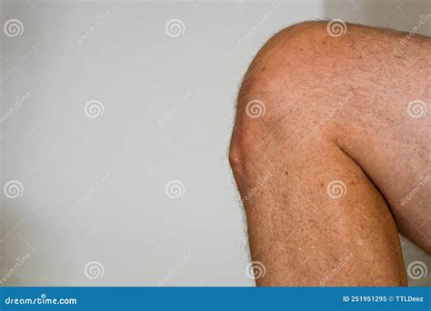 Osgood Schlatters In Adults Managing Osgood Schlatter Disease: Relief