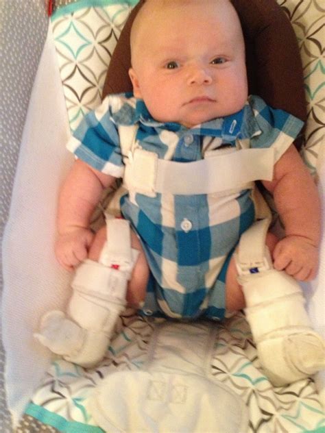 Your baby has hip dysplasia a tale of the pavlik – Artofit