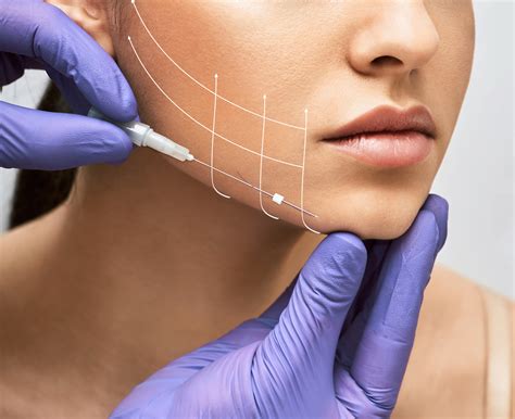 Best Thread Lift Procedures in Abu Dhabi - Aura Aesthetics