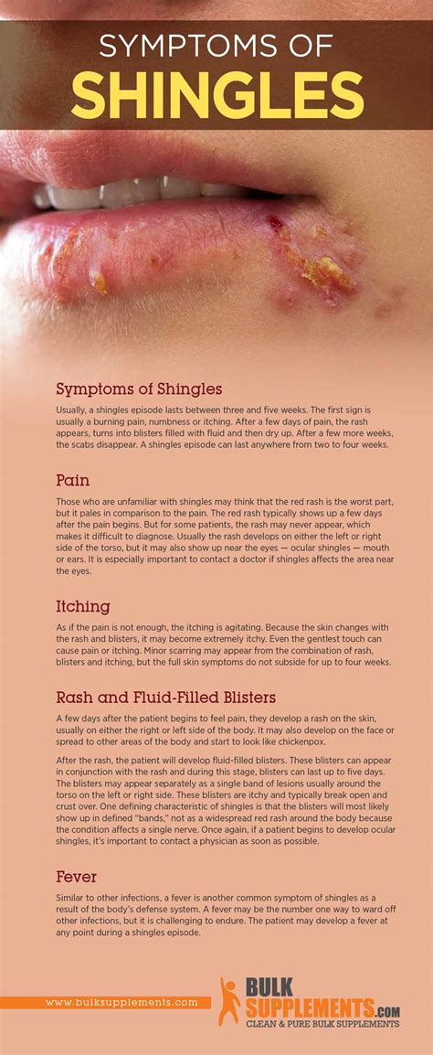 Healing Stage Of Shingles