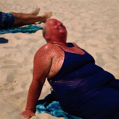 Sunburn Competition: The Wildest Day Under the Sun