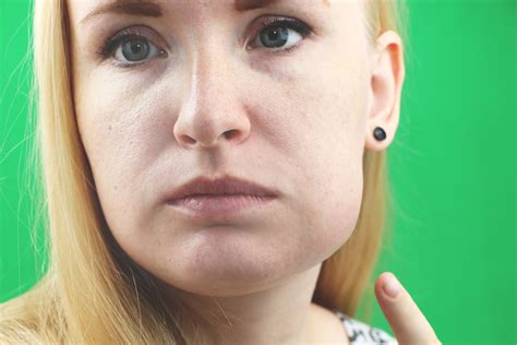 Pain In Cheek Bone Toothache at Melissa Acker blog