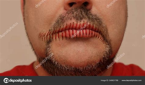 What Is Mouth Stitched Shut at Kristie Rhodes blog