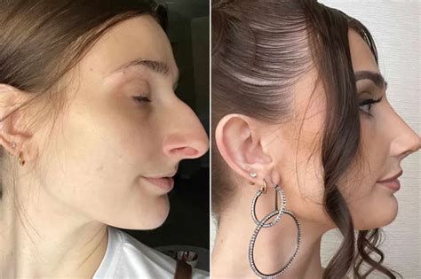 What is ‘looksmaxxing?’ Young men are justifying extreme physical transformations with pseudoscience