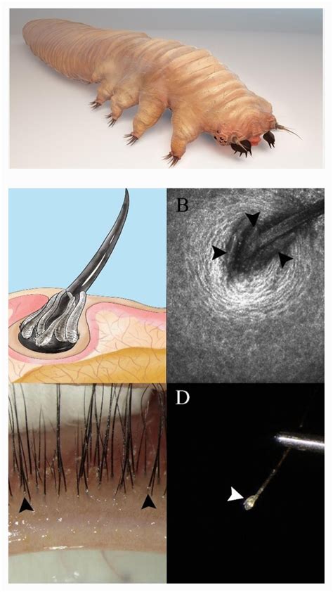 This is a demodex mite which live in your eyelashes - staying hidden in the follicles during the ...