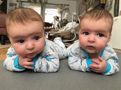 Identical Twins Mirror Organs at Tina Lown blog