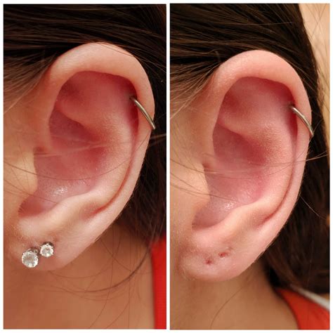Infected Ear Piercing: Symptoms And How To Treat It Glamour, 55% OFF