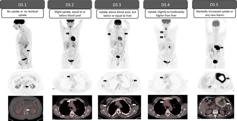 Lacey Duvalle Onlyfans