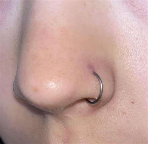 Nose piercing discoloring(bump?) : r/piercing