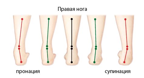 Нейтральная или избыточная пронация и супинация стопы при беге.