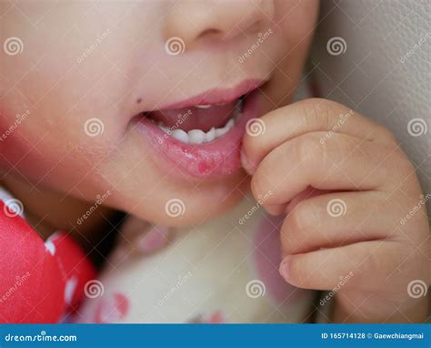 Little Baby Girl Scratching Her Dry Chapped Lips - Cracked, Rough ...