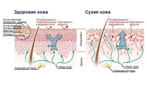 Как лечить ксероз кожи в пожилом возрасте: медикаменты, диета и ...