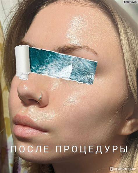 Контурная пластика скул - «Контурная пластика лица: Гармонизация ...