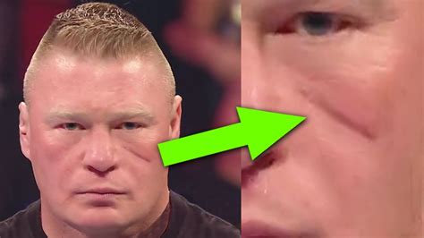 Brock Lesnar Teeth Condition : Brock Lesnar K29656ar Sd0318 Press ...