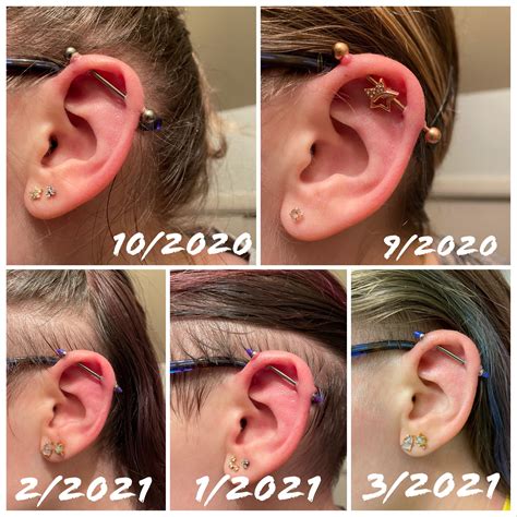 Industrial piercing bump journey! : r/piercing