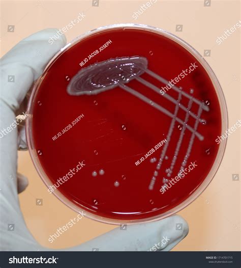 Blood Agar Alpha Beta Gamma
