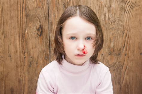 KidzAid Australia | Childrens Nosebleeds - KidzAid Health Facts