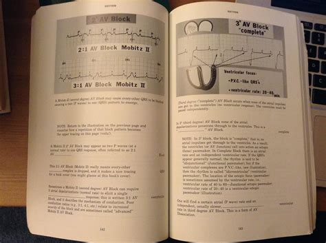 Rapid Interpretation of EKG's FOURTH EDITION: Dale Dubin: Amazon.com: Books