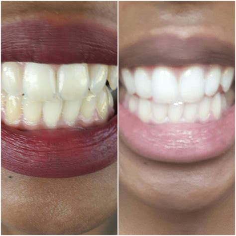 Oracare - Alexandra. Projects, photos, reviews and more | Snupit