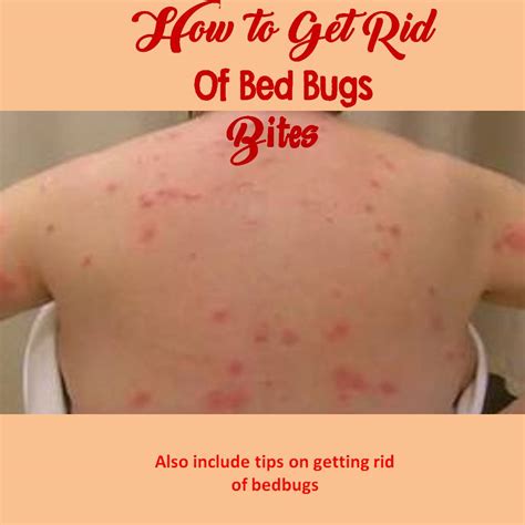 Can Bed Bugs Cause Rash On Face at Cameron Frodsham blog