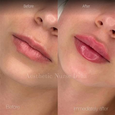 Cosmetic Treatments Before and After Gallery
