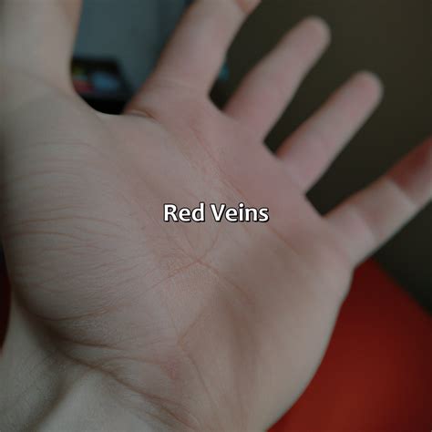 What Does The Color Of Your Veins Mean - colorscombo.com