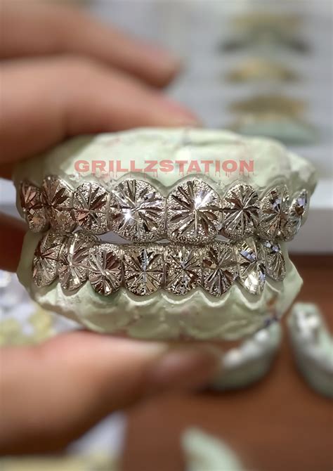 Diamond teeth grillz – Artofit