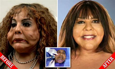 Lady Injecting Fix A Flat