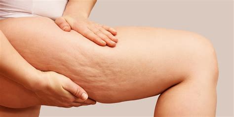 Exossomos na Dermatologia: o Essencial do Artigo-Guia Brasileiro de 2025 - Atlas da Dermatologia