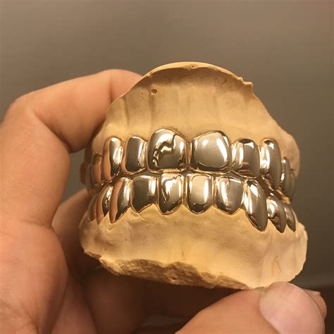 Gold Teeth Grillz