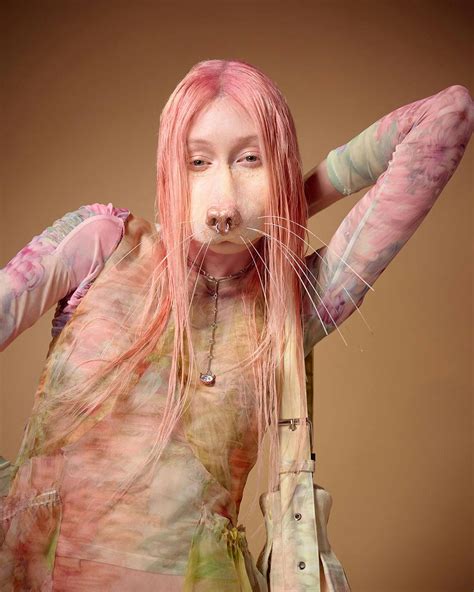 Why Are Prosthetics All Over the Red Carpet & Runway?