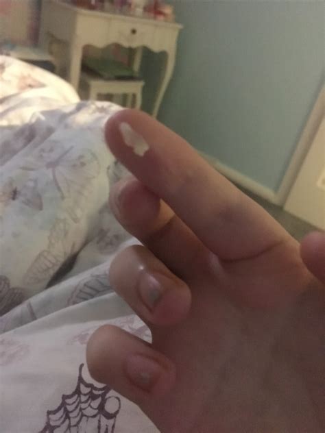 39 weeks and 2 days!!! clear gooey jelly discharge - Glow Community