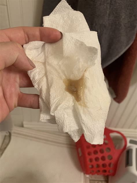 Mucus plug? Picture — The Bump