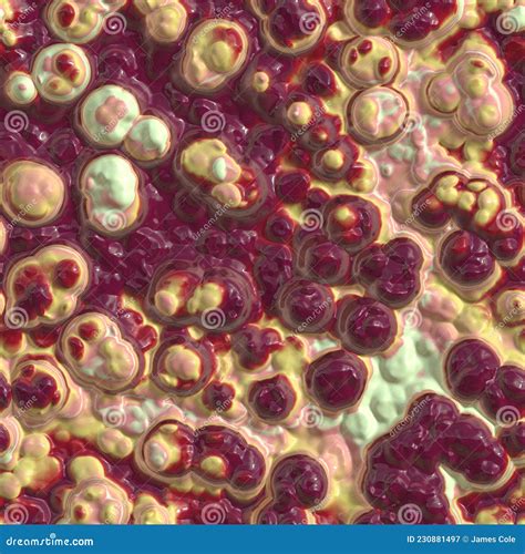 Yeasty Pus Filled Bloody Pimples Popped 3D Illustration Seamless ...