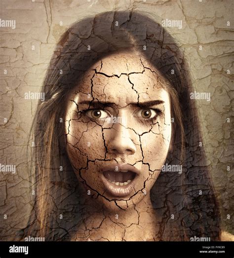 Dry cracked skin hi-res stock photography and images - Alamy