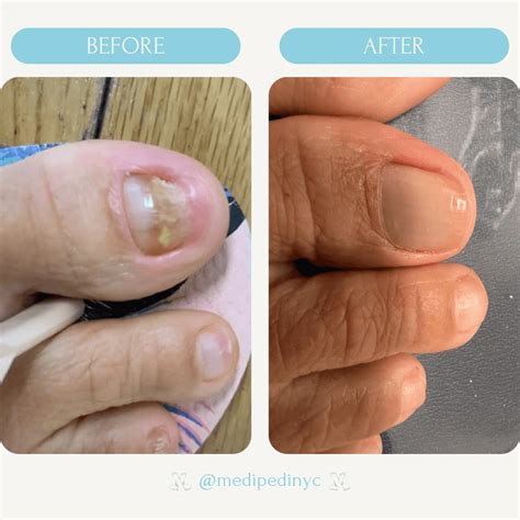 Medical Pedicures 2025: Your Complete Guide | belliata.com