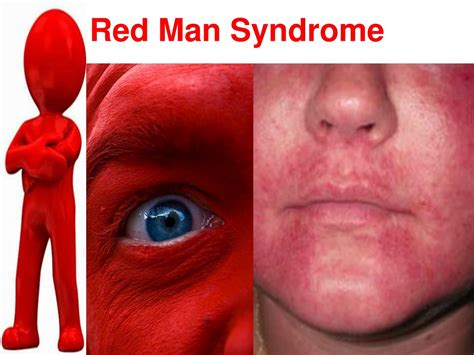 PPT - Beta – Lactam Antibiotics PowerPoint Presentation, free download ...