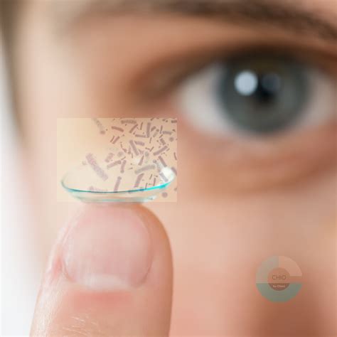 Eye infections from Contact Lenses use — Contact lens plunger - The CHIO