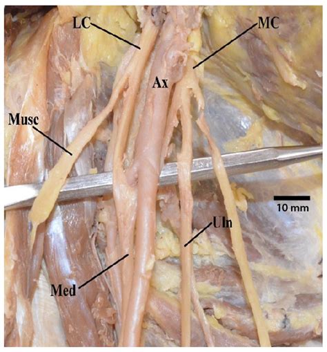 Brachial Plexus Anatomy Model