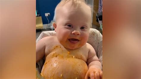 Funny Down Syndrome Pictures