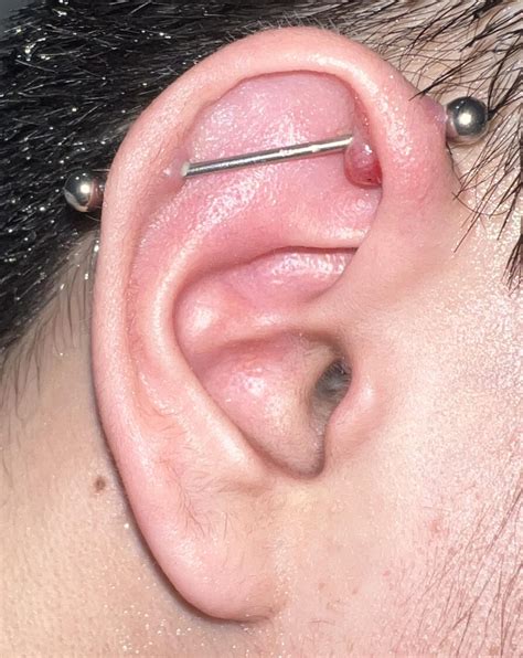 Keloid Industrial Piercing Ear Piercings: 14 Popular Piercing Types