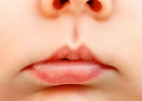 Quivering Lip In Newborn