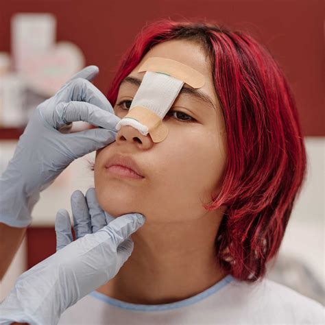 Rinoplasty (NOSE) - Go Surgery Tijuana